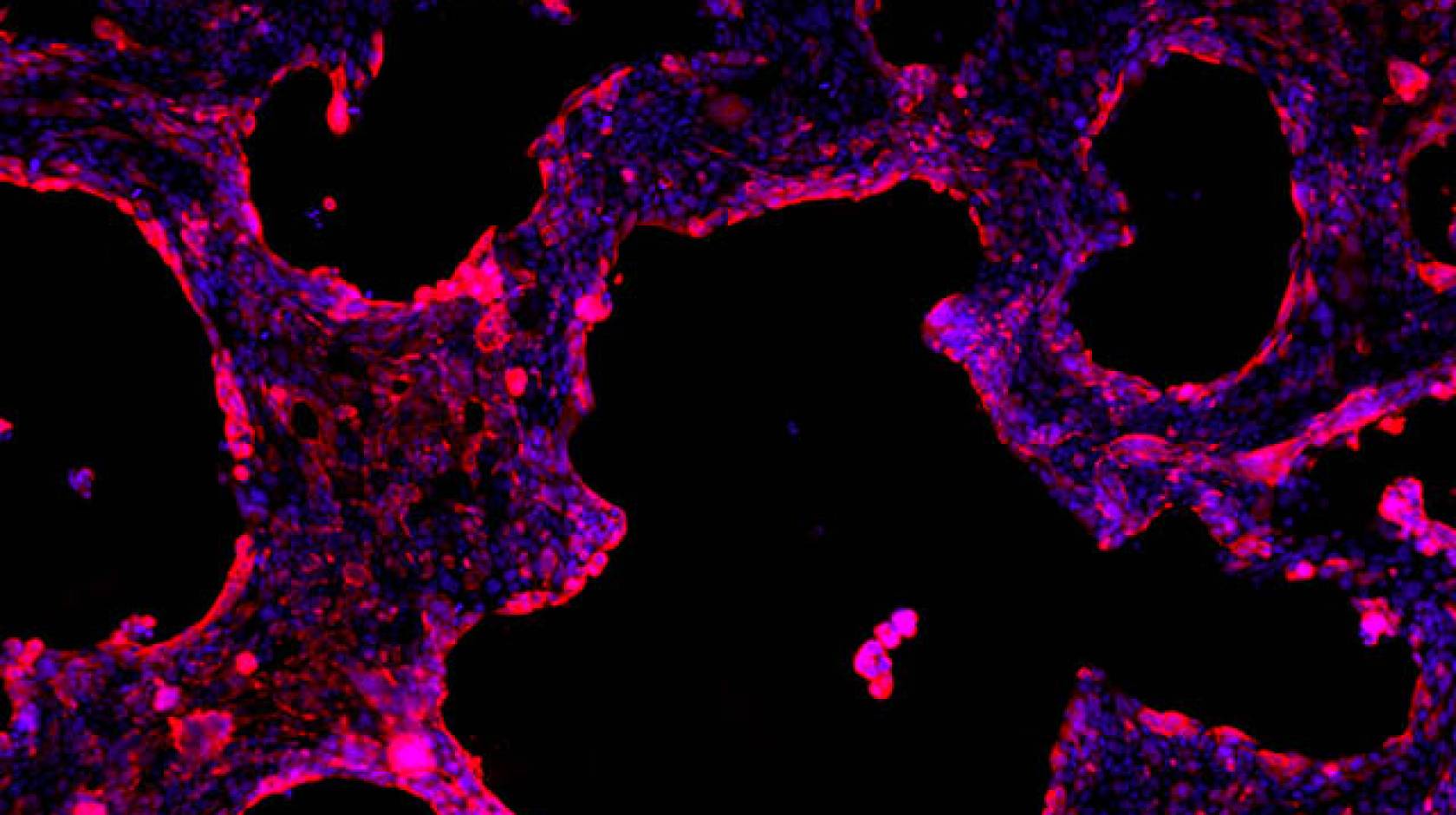 Human lung epithelial cells close up