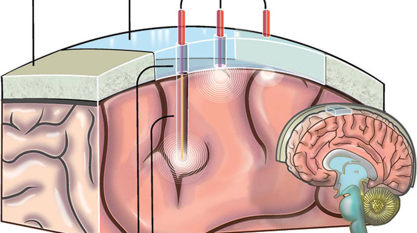 &#039;window to the brain&#039; graphic