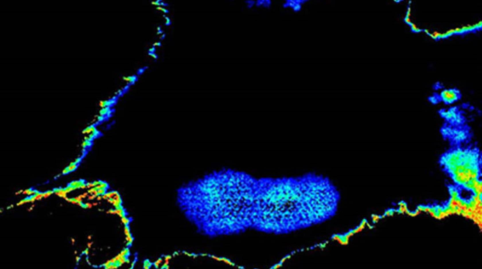 Tumor cell UC San Diego