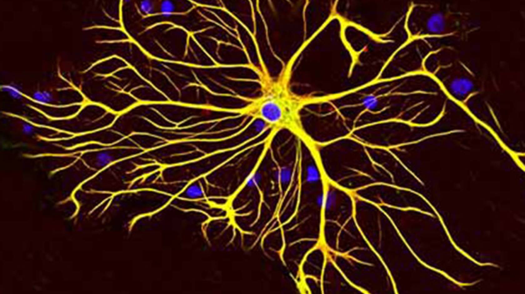 A human astrocyte grown in tissue culture. The blue stain indicates DNA inside the astrocyte’s nucleus and in other nearby cells.