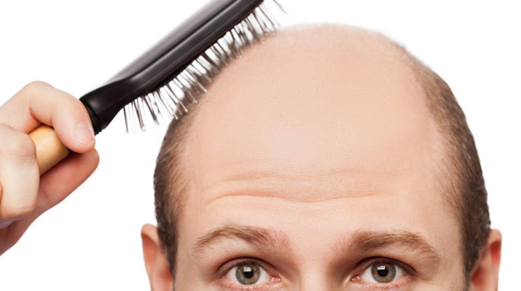 new research for baldness