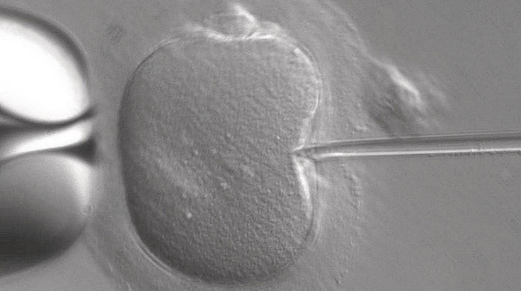 UCSF fertility technique