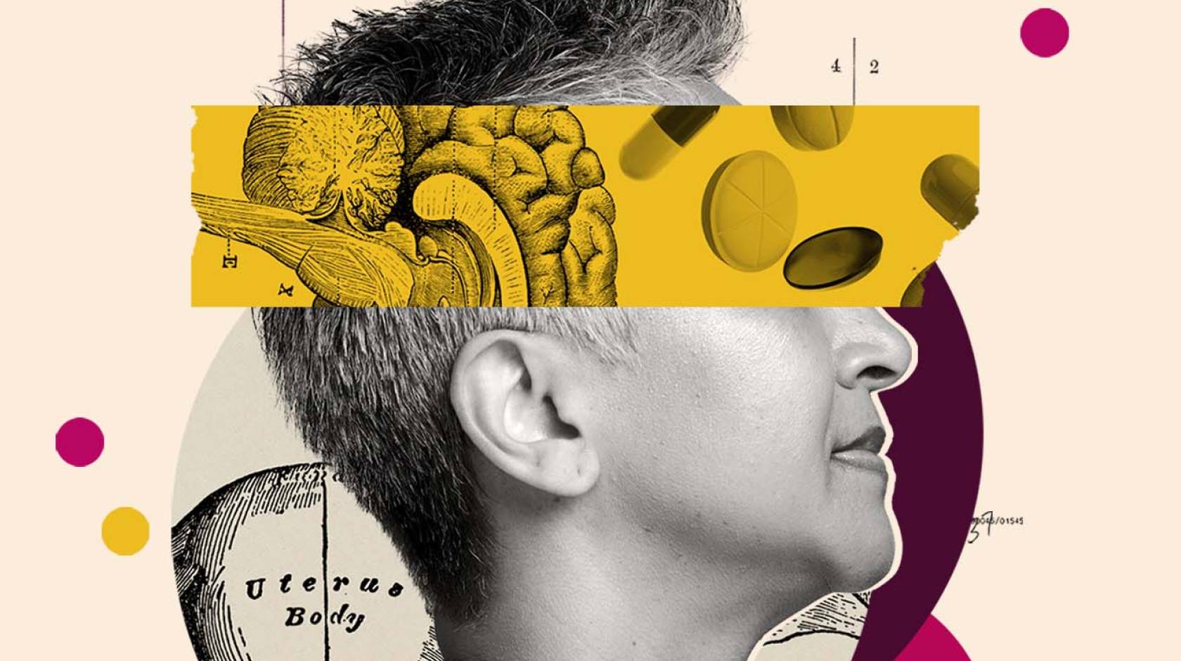 A woman, neck up, in profile, with short salt and pepper hair in silhouette and a collage cutout of a brain and pills over her eyes, along with other collage illustrations in the backdrop and dots