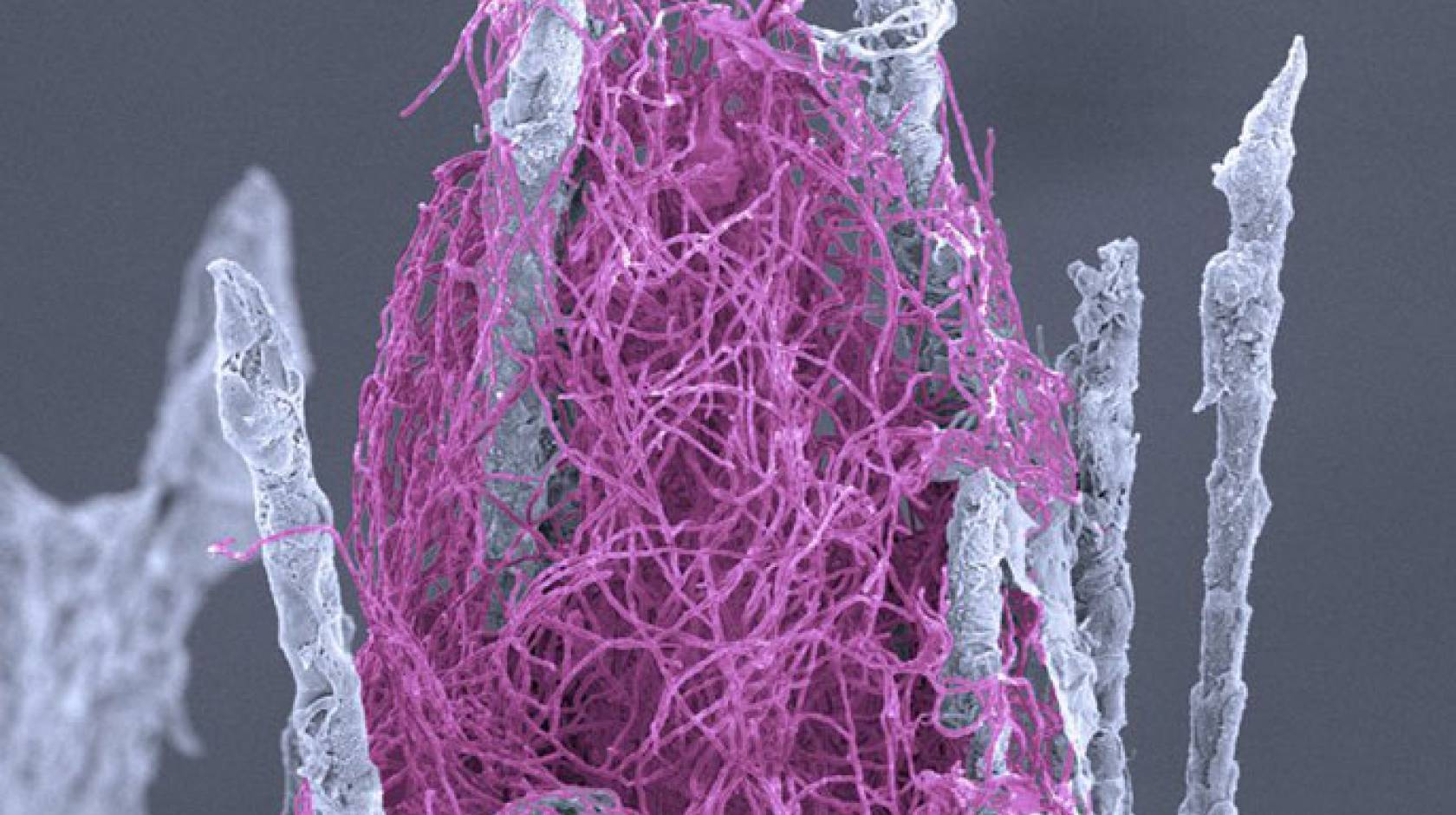 A thick tangle of the fungus Pseudogymnoascus destructans (purple) that causes white-nose syndrome in bats is shown here growing on mouse body hair. 