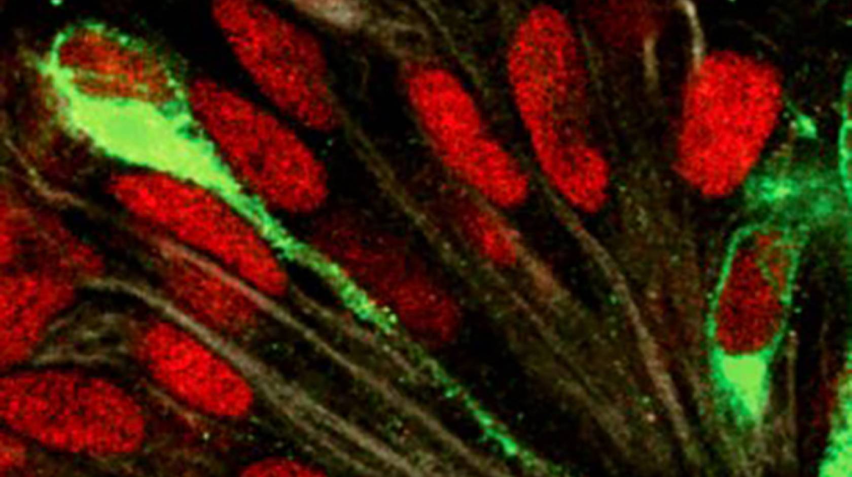 Infection of developing human brain with the Zika virus (green) highlights susceptibility of radial glial cells during fetal development.