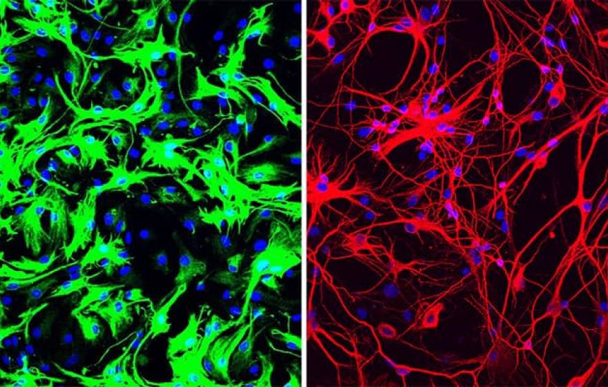 Left: mouse astrocytes (green) before reprogramming; Right: neurons (red) induced from mouse astrocytes after reprogramming with PTB antisense oligonucleotide treatment.