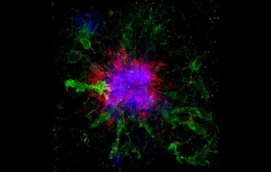 Confocal microscopy showing amyloid plaques in the brain of a mouse