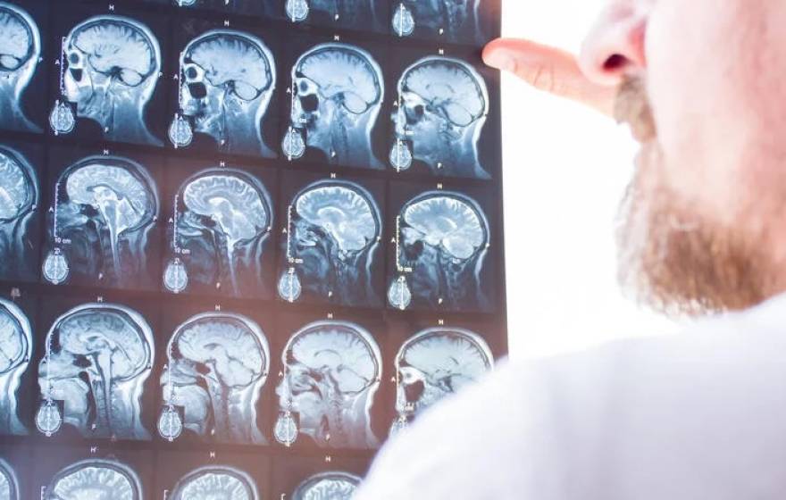 A shot over the shoulder from behind a bearded man wearing a white lab coat, holding a grid of brain scans up to a light wall to inspect them