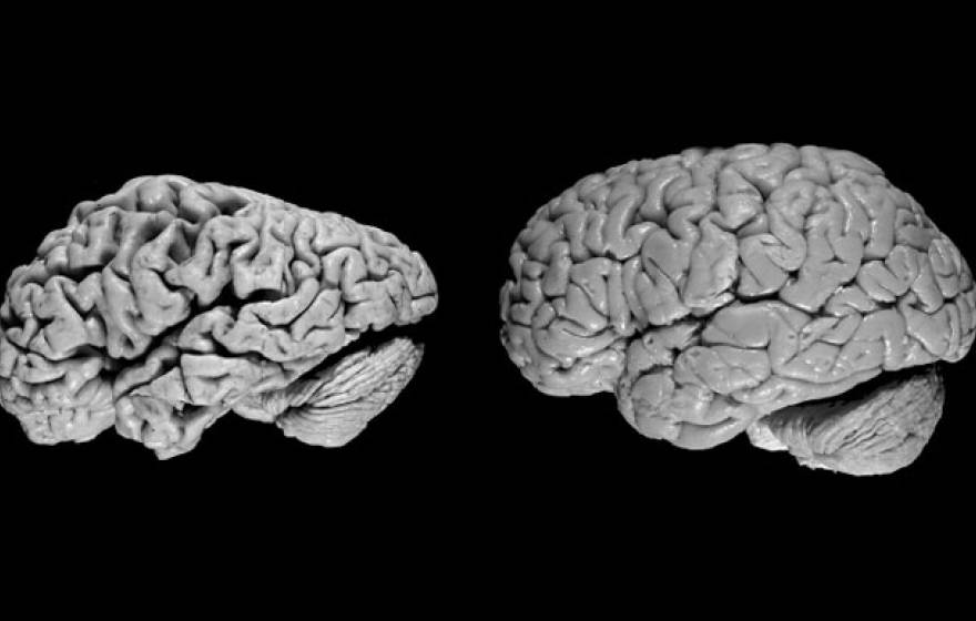 A comparison of two brains