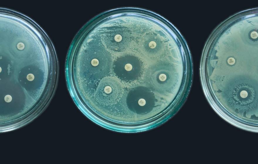 3 green cell culture agar plates show differing amounts of bacterial growth