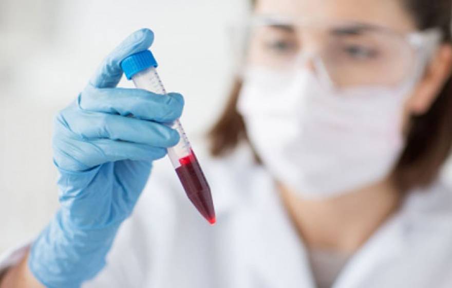 Female scientist holds blood vial