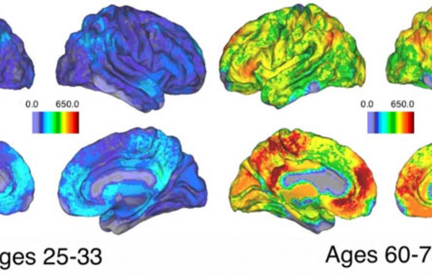 Brain activity UC Santa Barbara