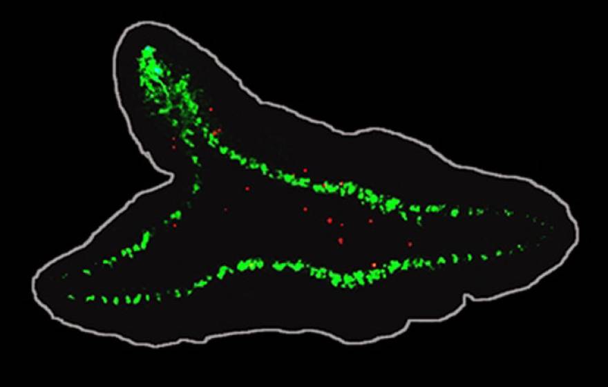 UC Merced cancer and brain cells