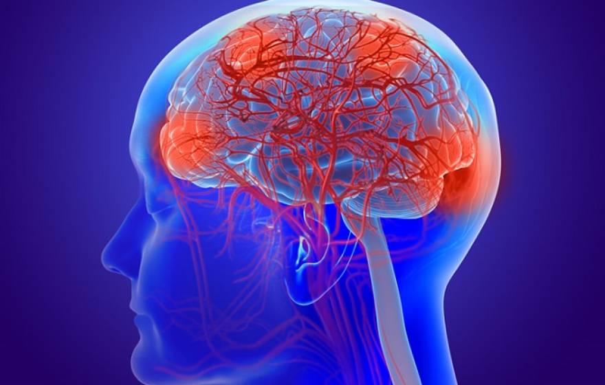 Brain inflamed stock image