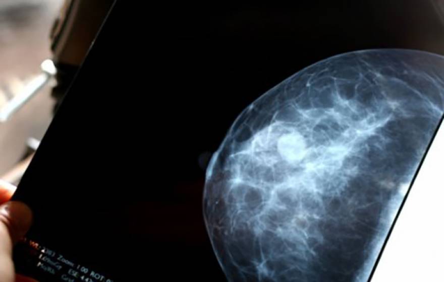 Breast scan