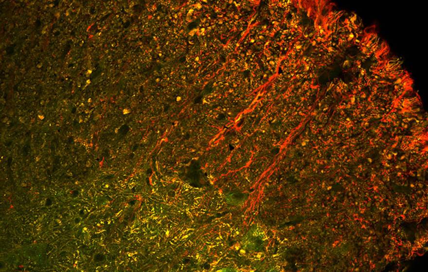 CRISPR UC Berkeley