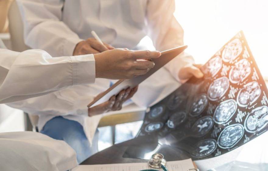 Doctors holding brain scans