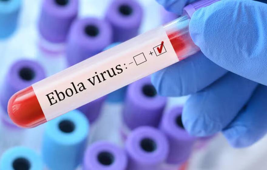 A pipette that says Ebola virus with a plus or minus check held by a gloved hand