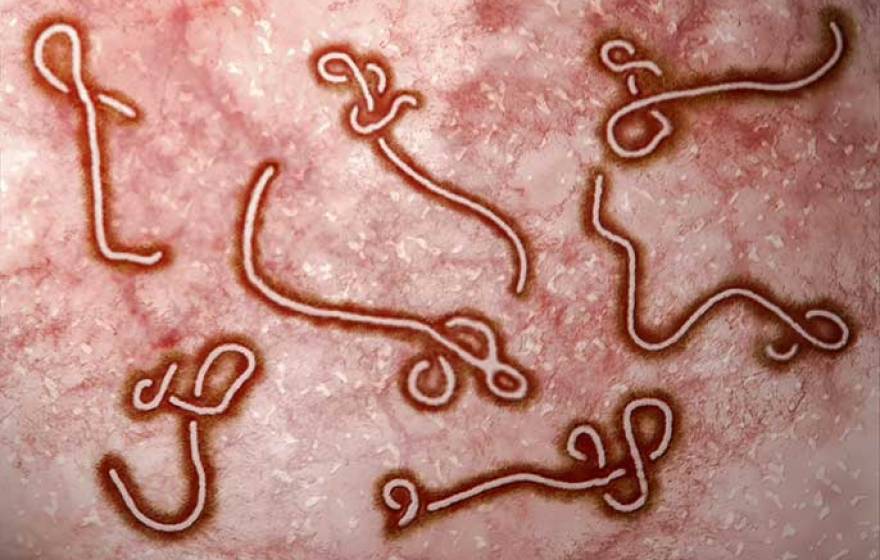 Ebola virus