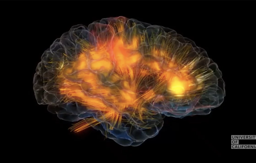 Glass Brain