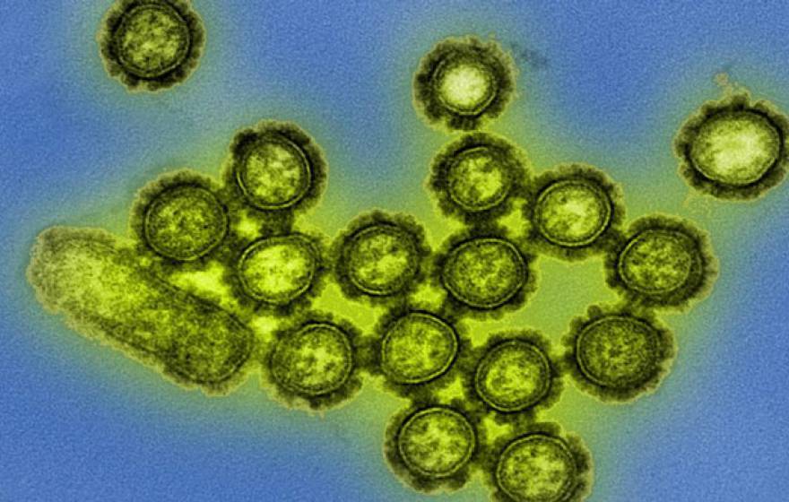 H1N1 virus UC Davis