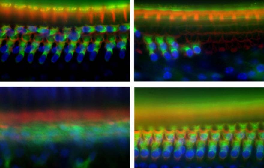 Four photos of hair cells relevant to the experiment