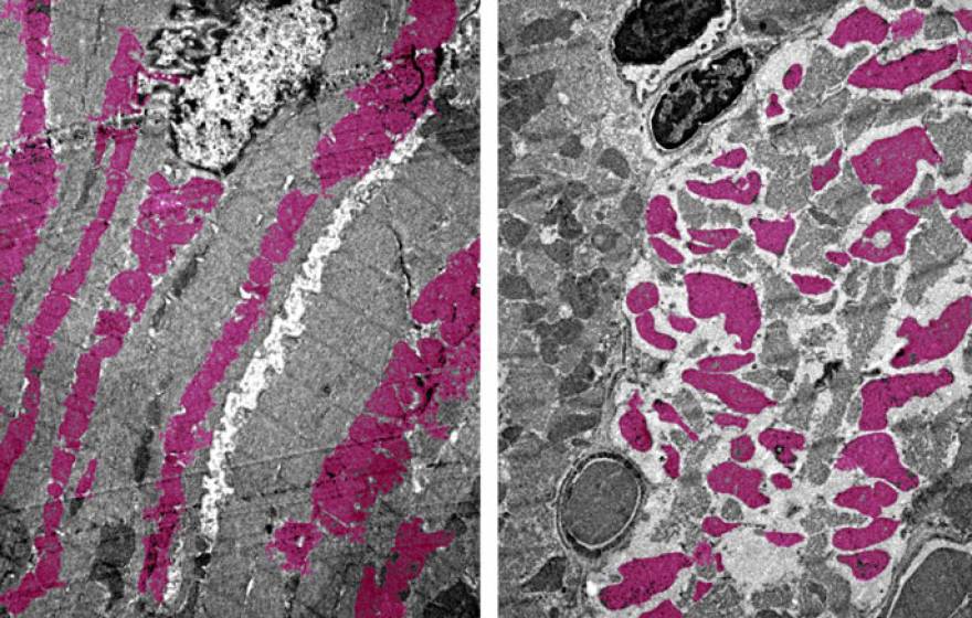 Heart muscle tissue close-up