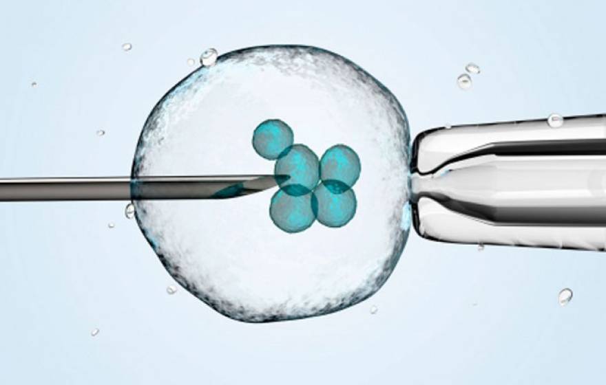 In vitro fertilization illustration