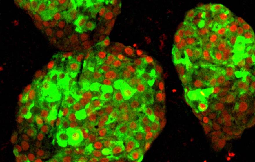 Pancreatic beta cells in a lab dish