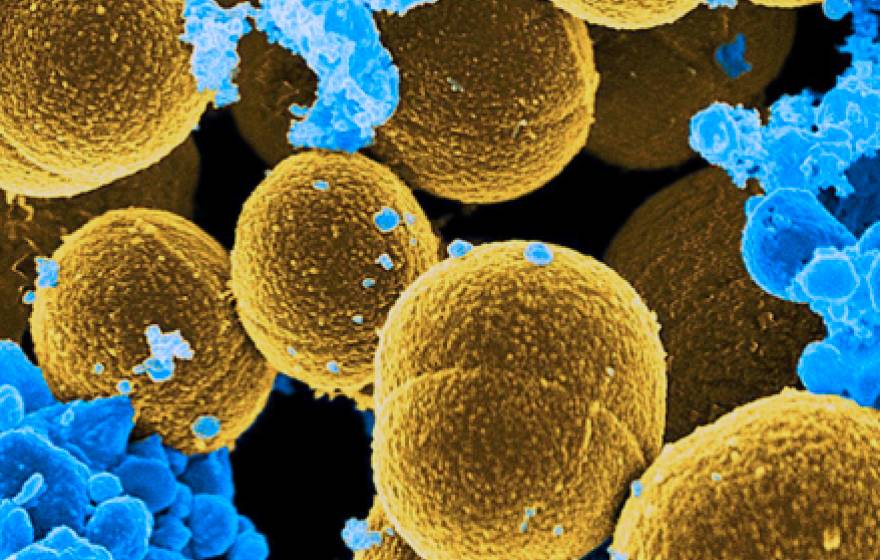 microbes