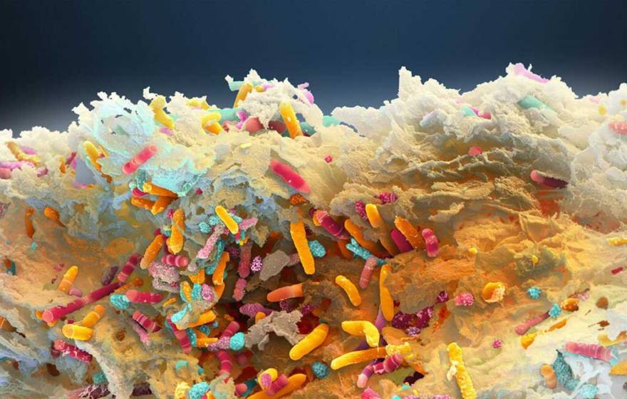 Colorful image of the microbiome as seen under a microscope (looks like fabrics from a rug)