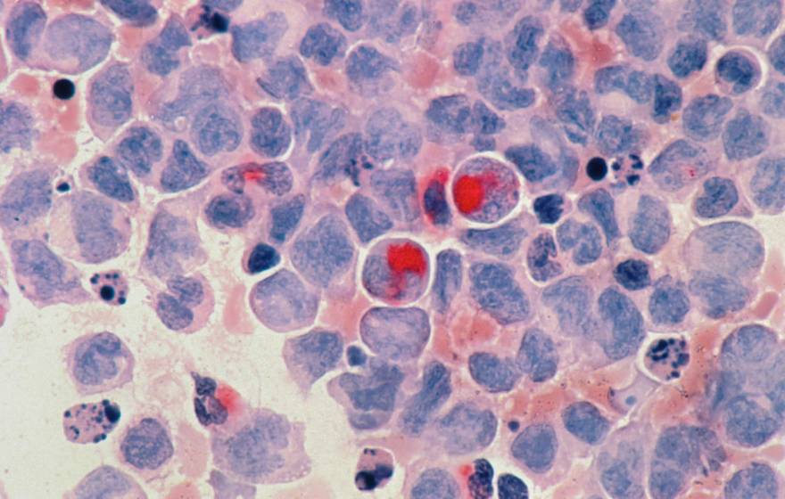 A microscopic view of purple and red cells