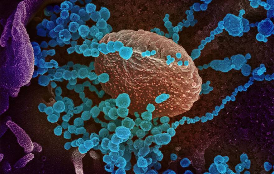 Illustration of novel cornoavirus SARS-CoV-2