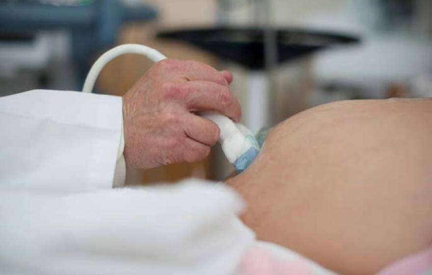 pregnancy ultrasound