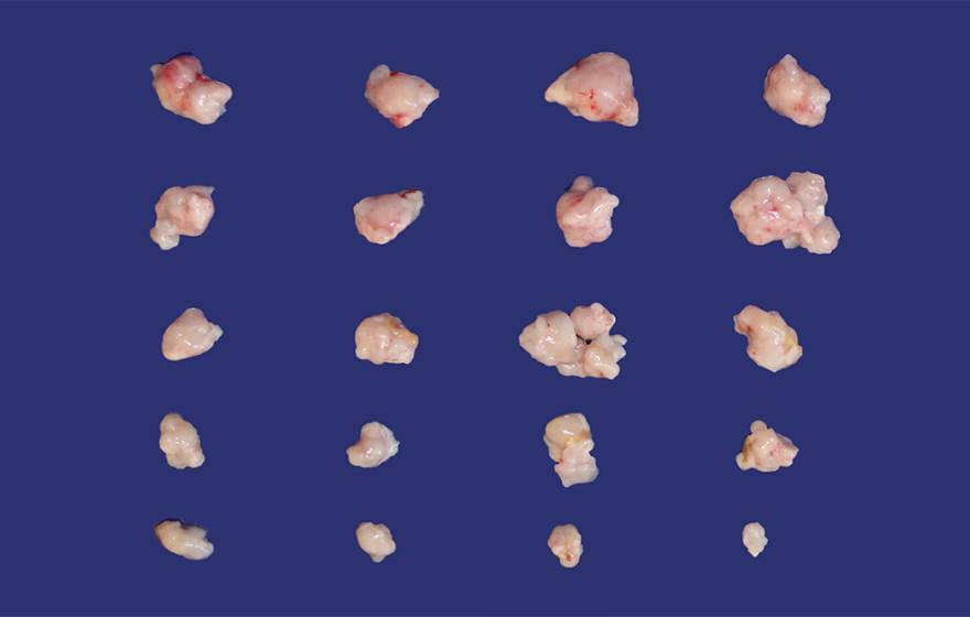 50 small tumors of different sizes, depending on how they are being treated