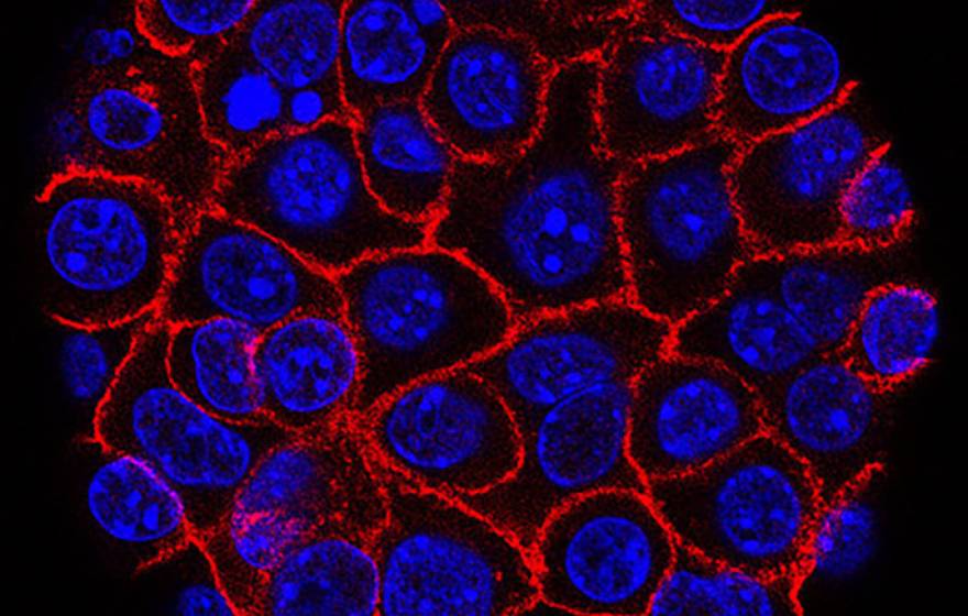 Pancreatic cancer cells