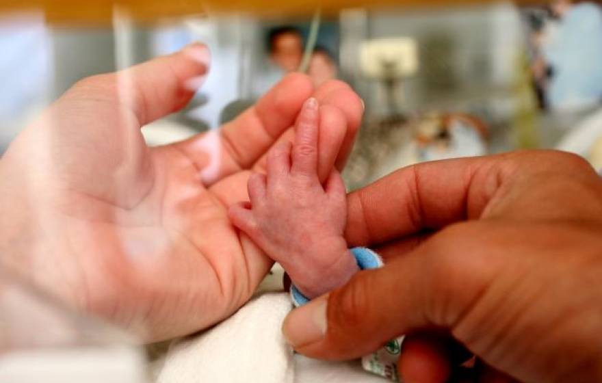 premature birth