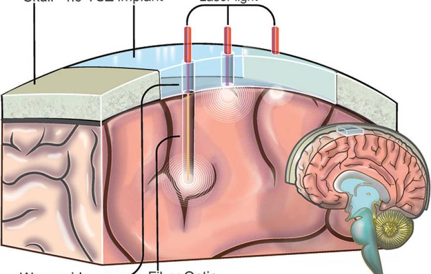 &#039;window to the brain&#039; graphic