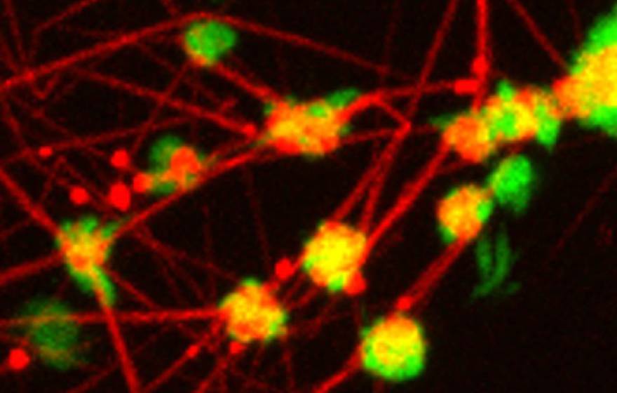 UC Riverside platelets fibrin