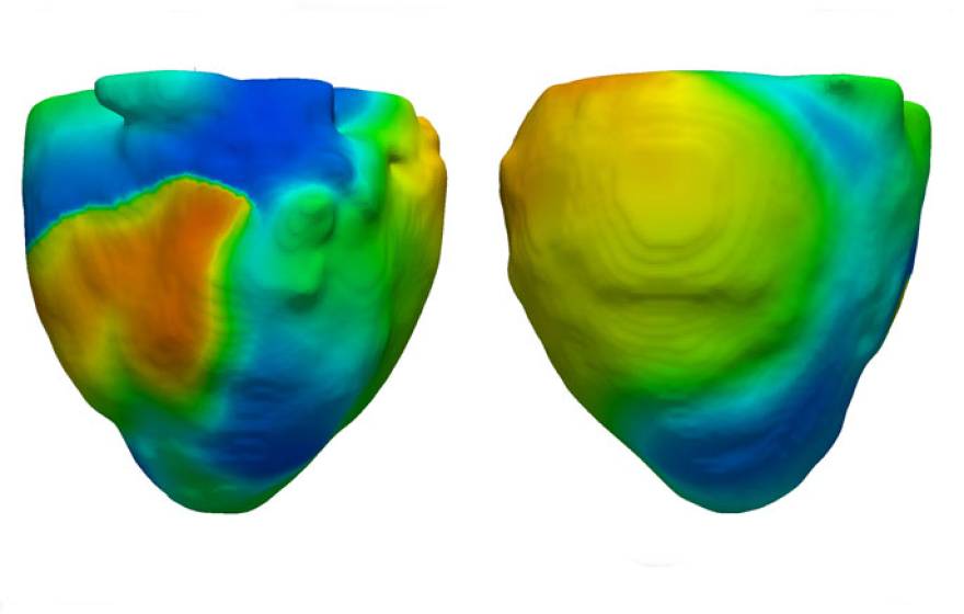 UCLA heart model