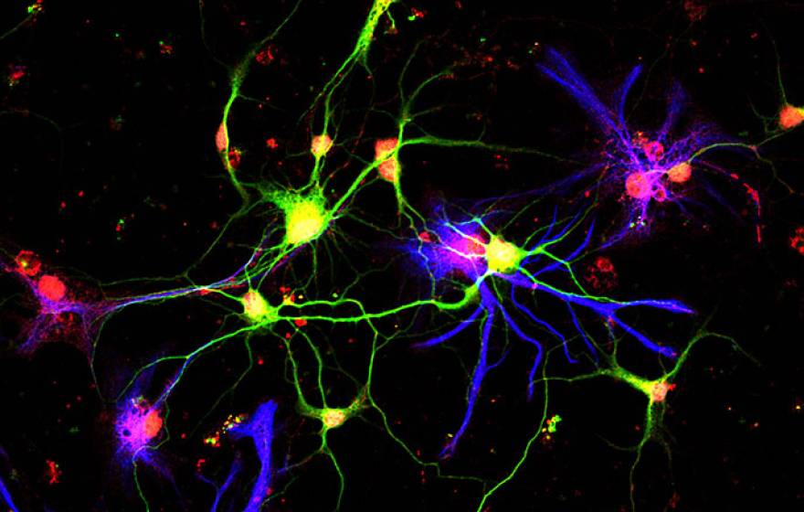 neurons making GDF10