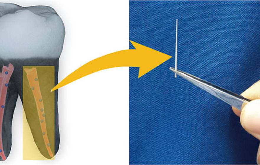 diagram, tooth and gutta percha