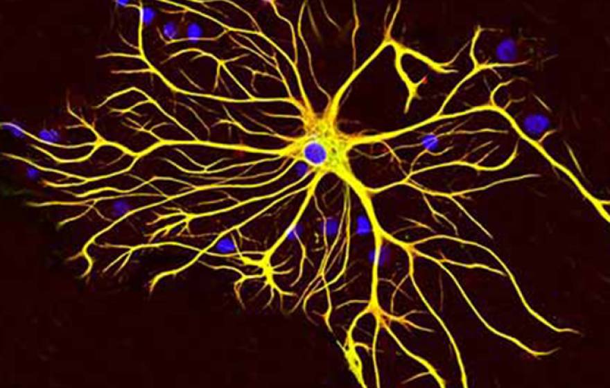 A human astrocyte grown in tissue culture. The blue stain indicates DNA inside the astrocyte’s nucleus and in other nearby cells.