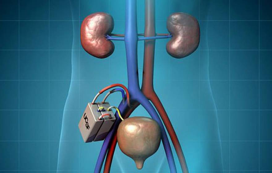 artificial kidney illustration