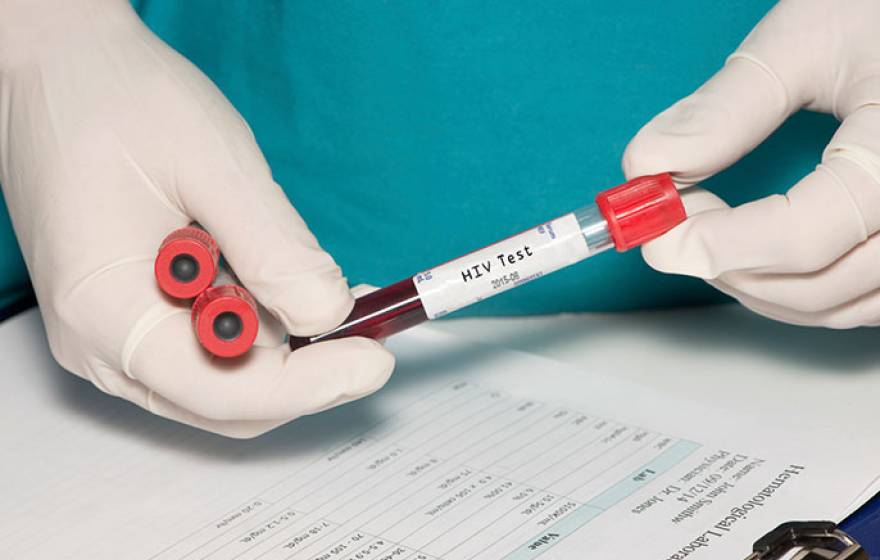 vial of blood labeled HIV test