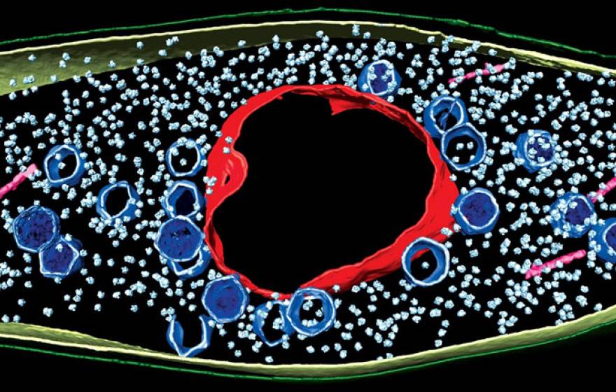 UC San Diego virus infected cell