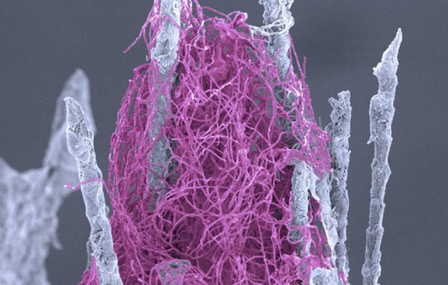 A thick tangle of the fungus Pseudogymnoascus destructans (purple) that causes white-nose syndrome in bats is shown here growing on mouse body hair. 