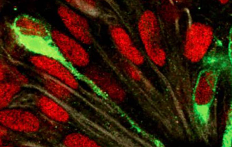 Infection of developing human brain with the Zika virus (green) highlights susceptibility of radial glial cells during fetal development.