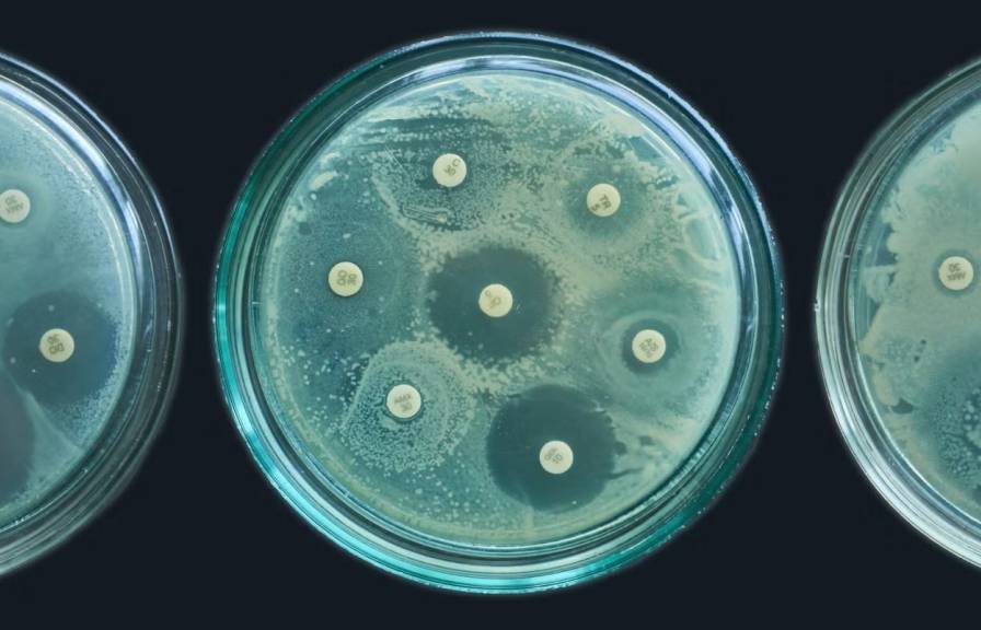 an antimicrobial resistance test in petri dishes