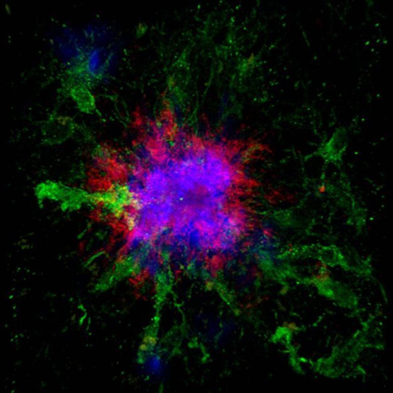 Confocal microscopy showing amyloid plaques in the brain of a mouse